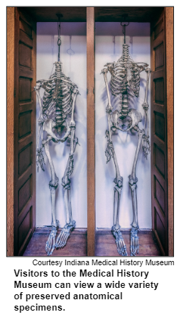 Visitors to the Medical History Museum can view a wide variety of preserved anatomical specimens. Courtesy Indiana Medical History Museum.